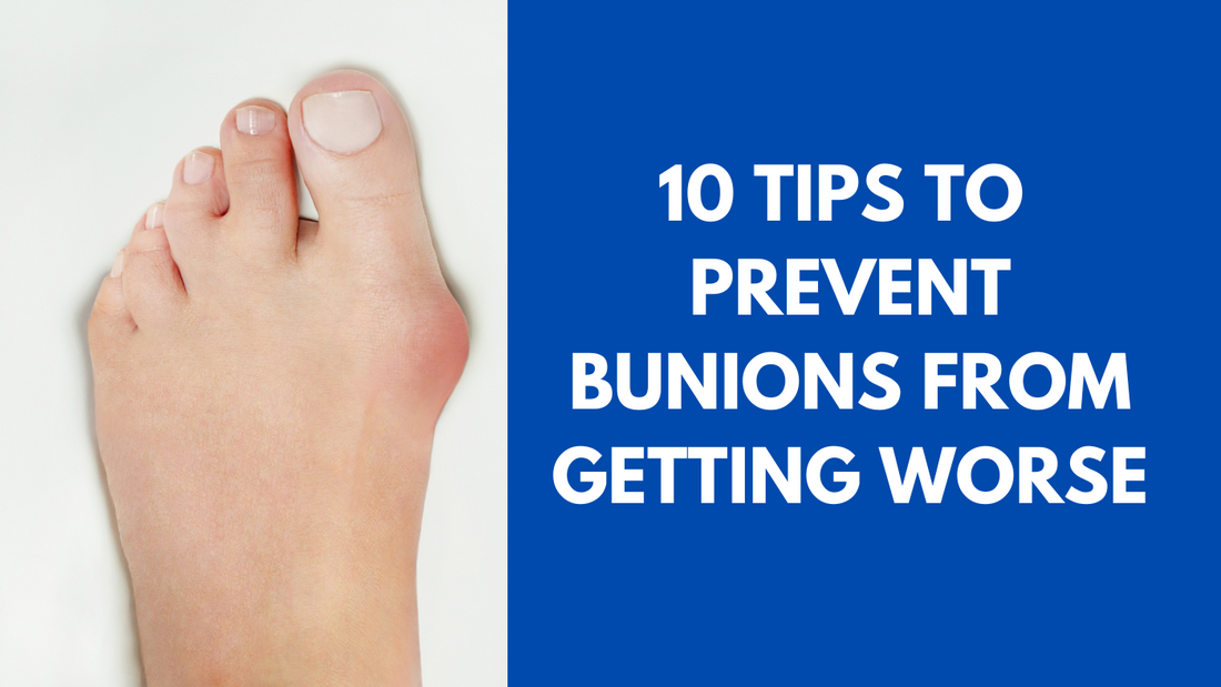 10 Tips to Prevent Bunions From Getting Worse