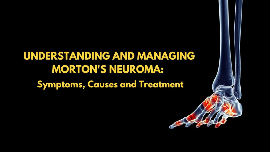 Understanding and Managing Morton's Neuroma: Symptoms, Causes and Treatment